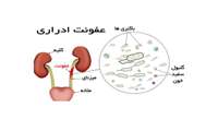 تب های غیر قابل توجیه، علامت عفونت ادراری در کودکان